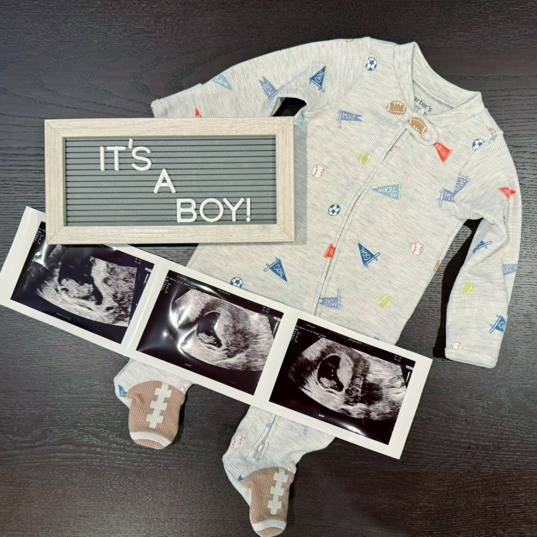 Photo shared by Katherine for their Babylist baby registry.