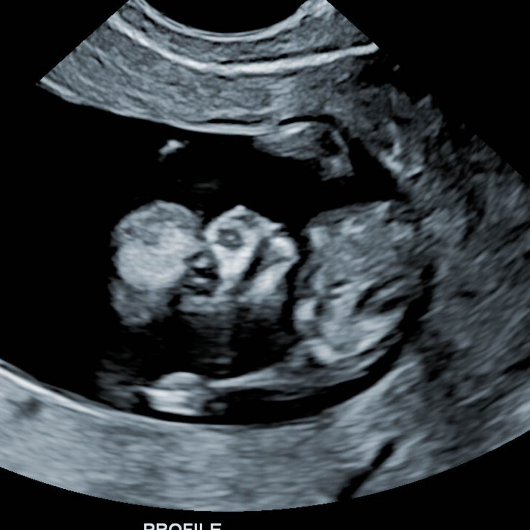 Photo shared by Alana for their Babylist baby registry.