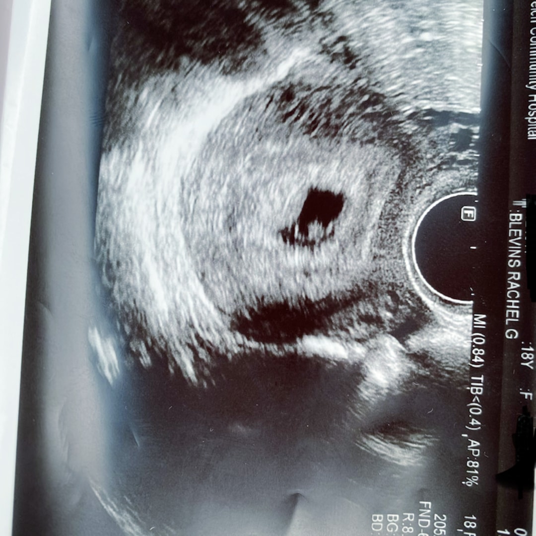 Photo shared by Rachel for their Babylist baby registry.