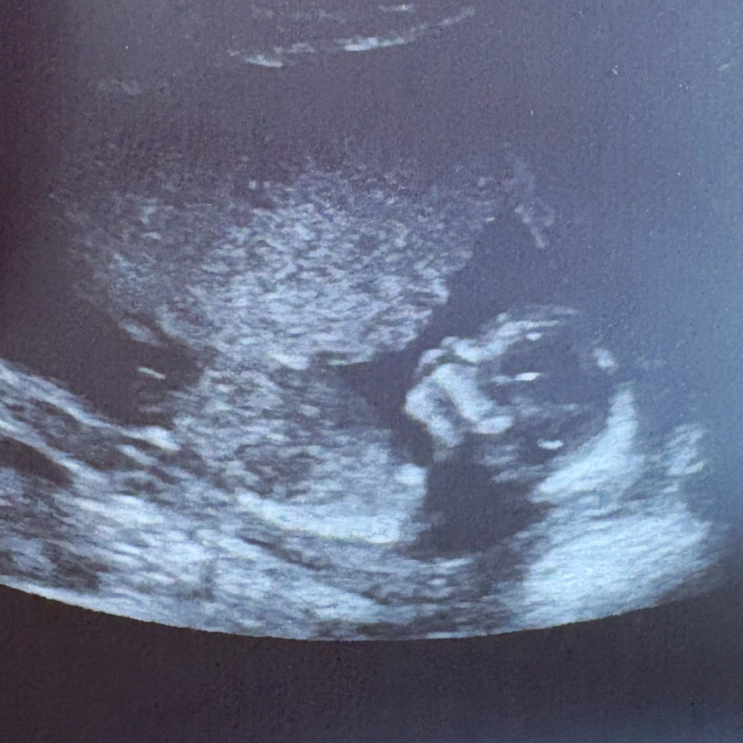 Photo shared by Athena for their Babylist baby registry.