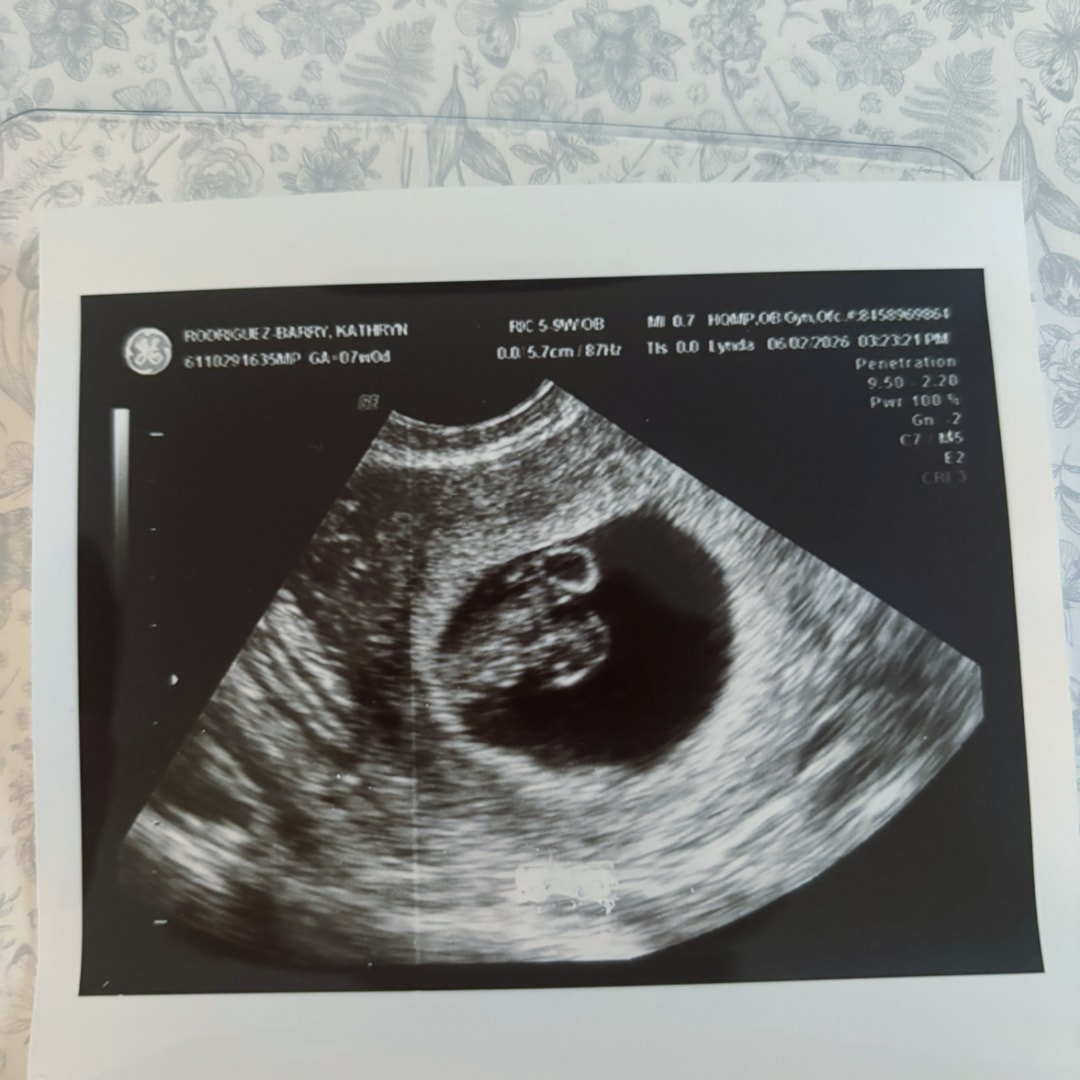 Photo shared by Kathryn for their Babylist baby registry.