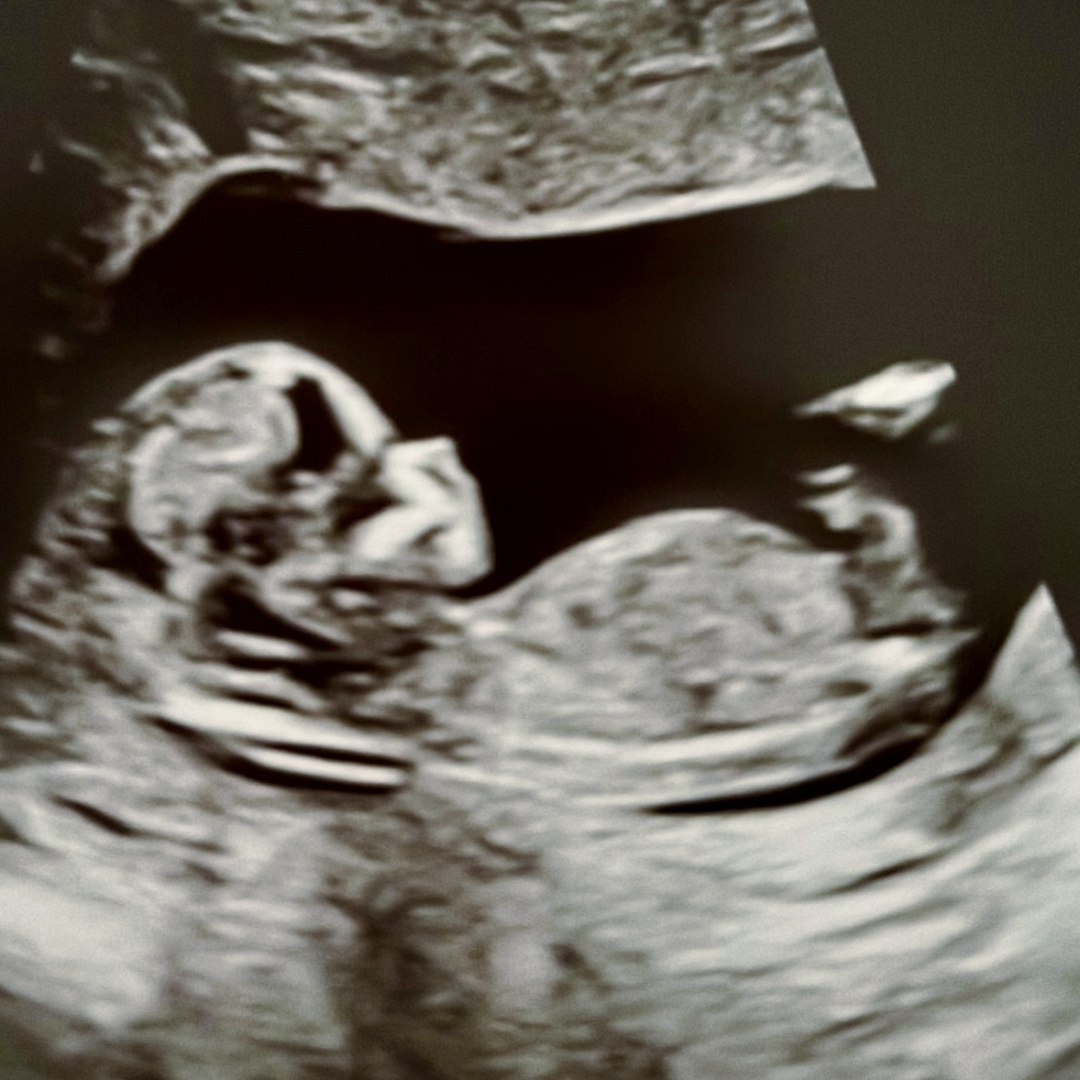 Photo shared by Amanda for their Babylist baby registry.