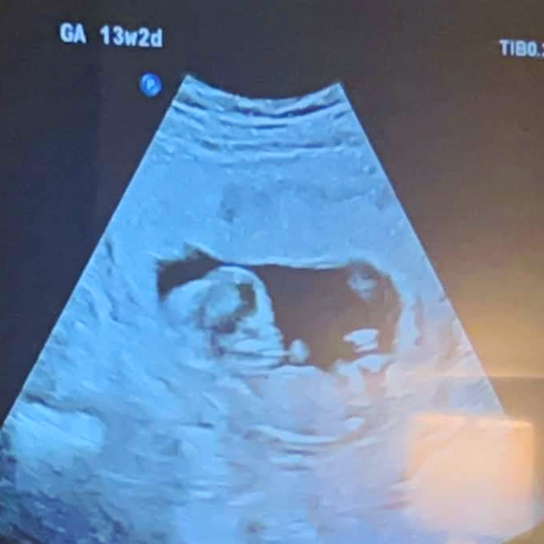 Photo shared by Amanda for their Babylist baby registry.