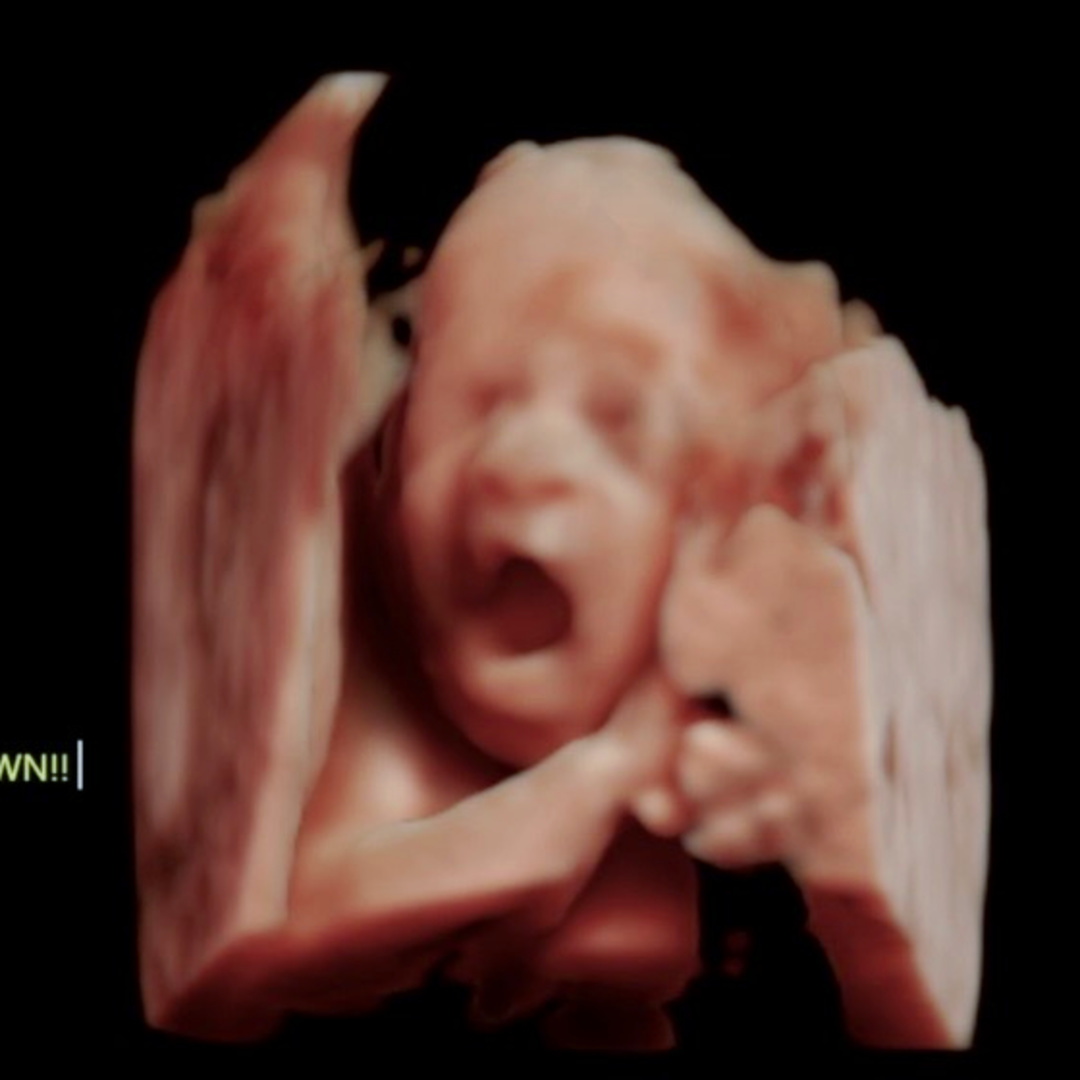 Photo shared by Jasmine for their Babylist baby registry.