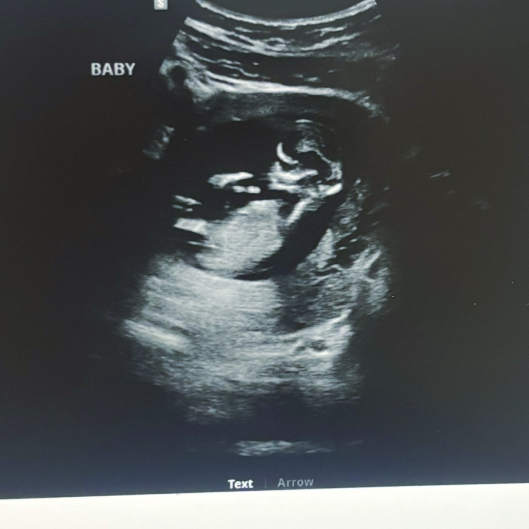 Photo shared by Brittini for their Babylist baby registry.
