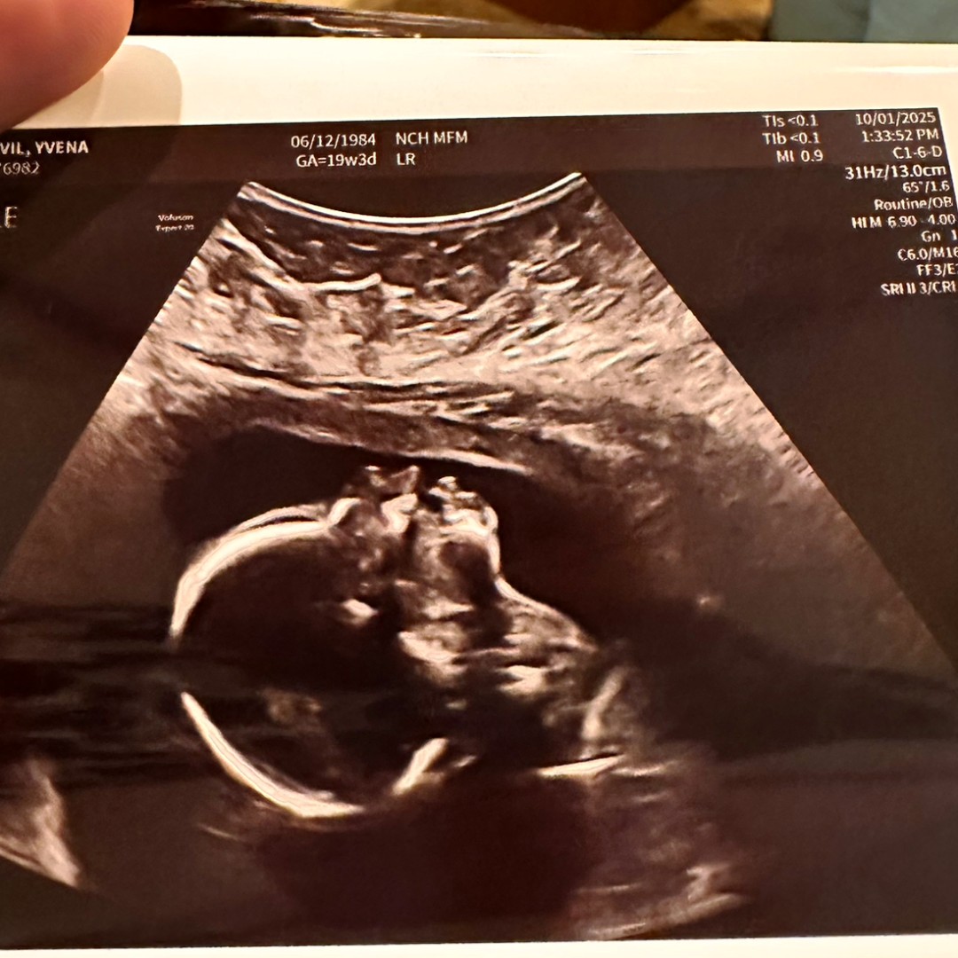 Photo shared by Yvena for their Babylist baby registry.