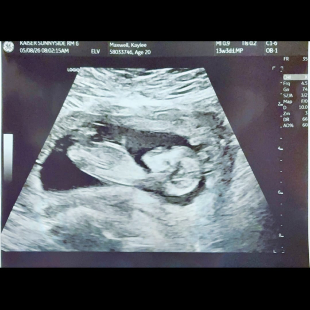 Photo shared by Kaylee for their Babylist baby registry.