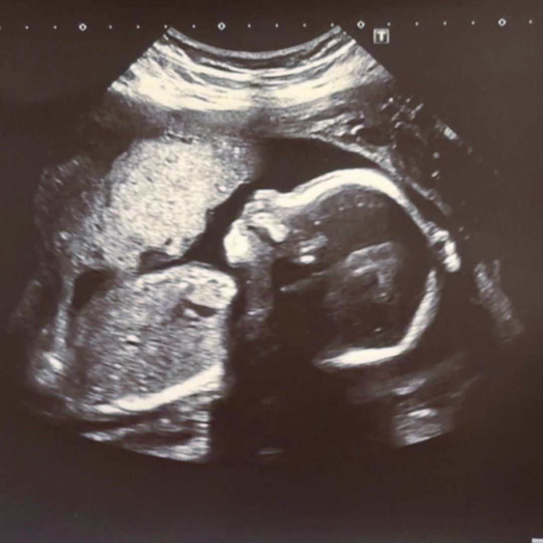 Photo shared by Bella for their Babylist baby registry.