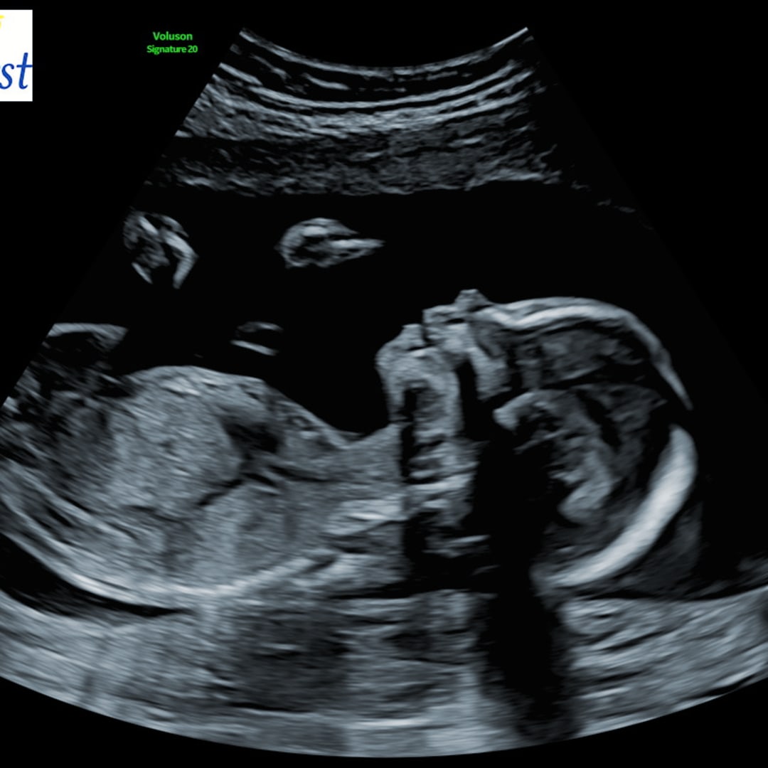 Photo shared by Lauren for their Babylist baby registry.