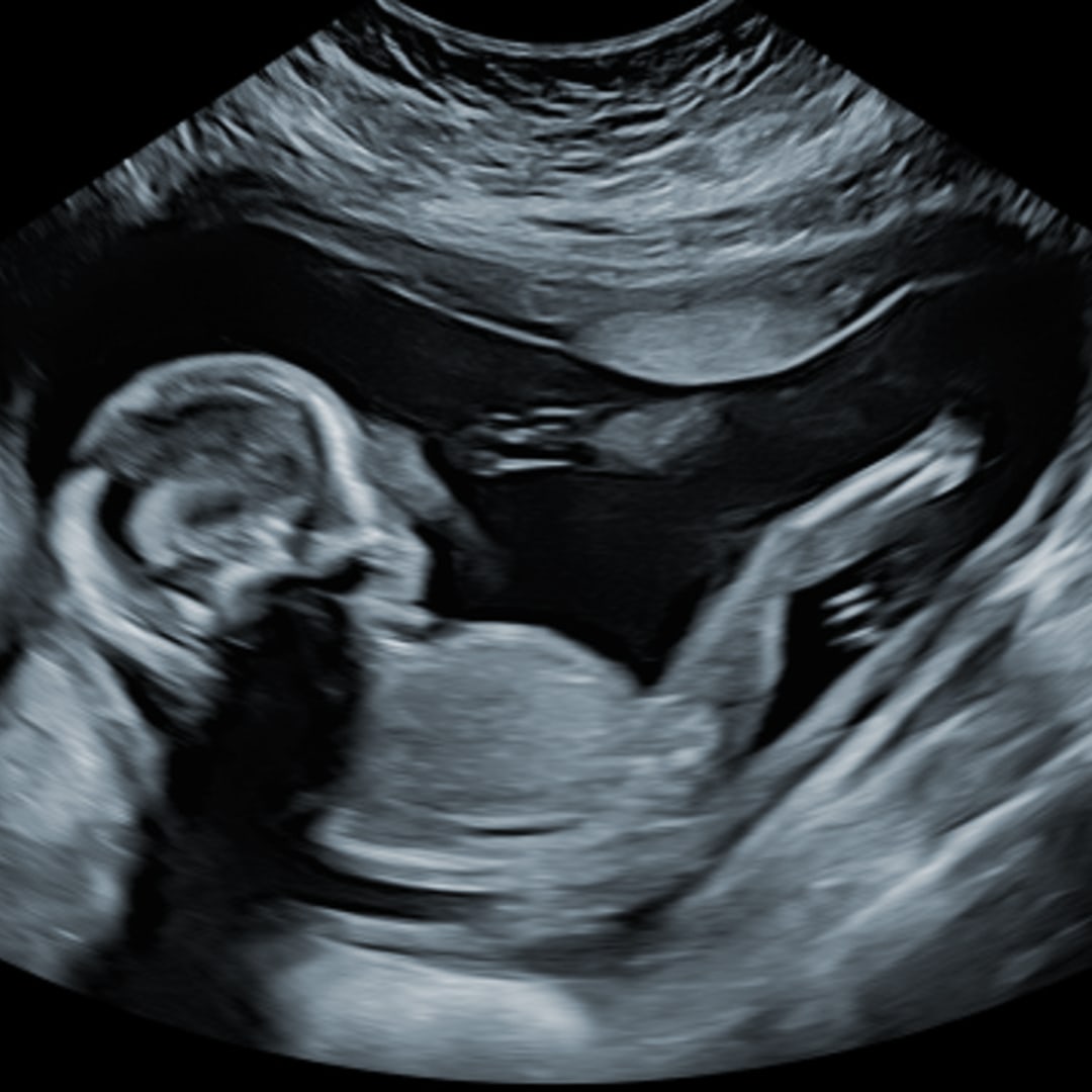 Photo shared by Alondra for their Babylist baby registry.