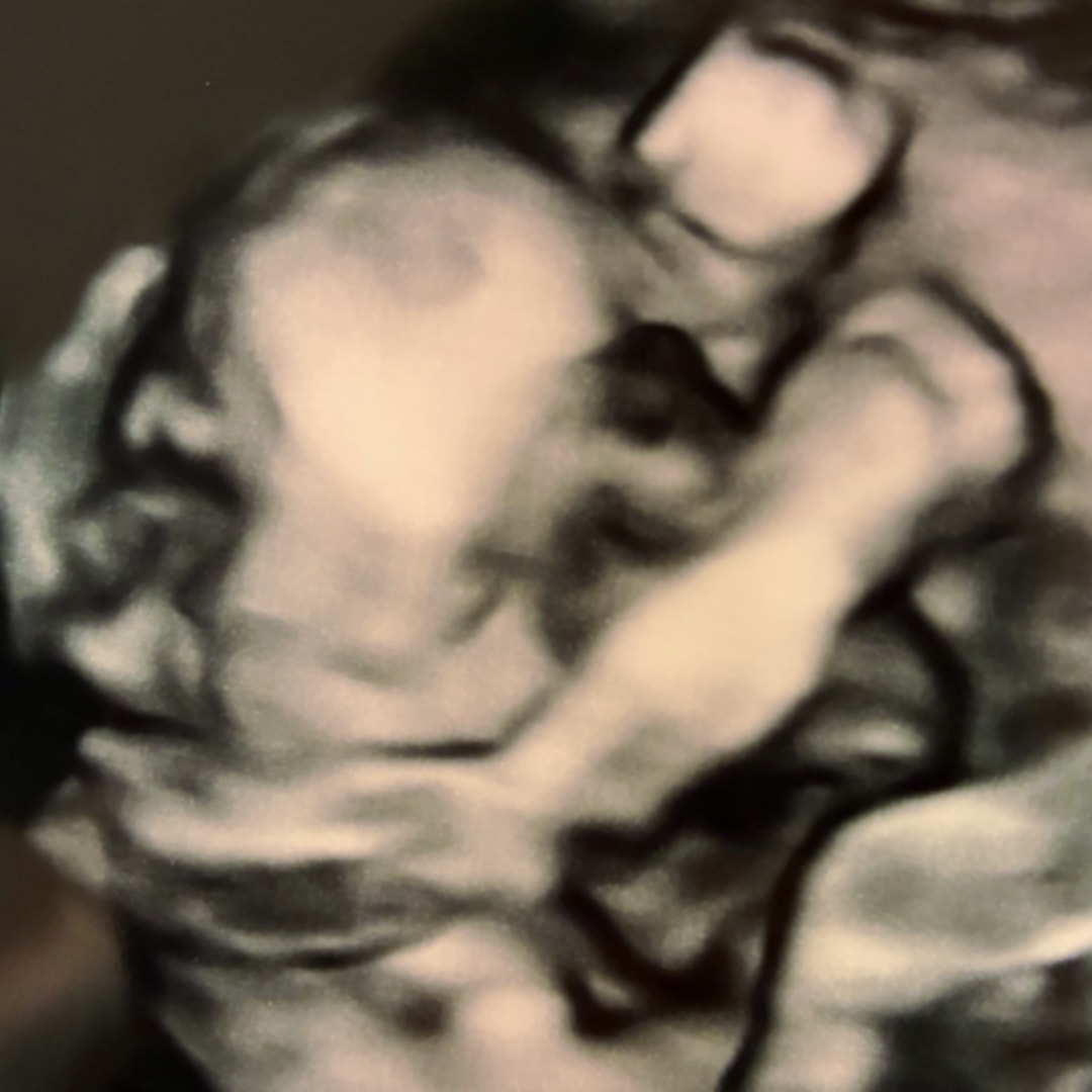 Photo shared by Theresa for their Babylist baby registry.