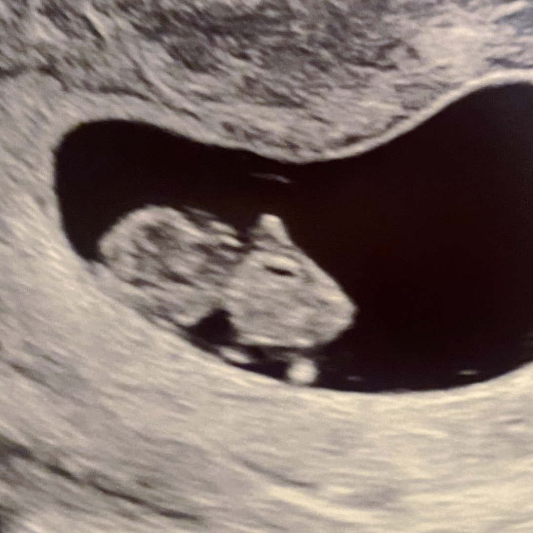 Photo shared by Emma for their Babylist baby registry.