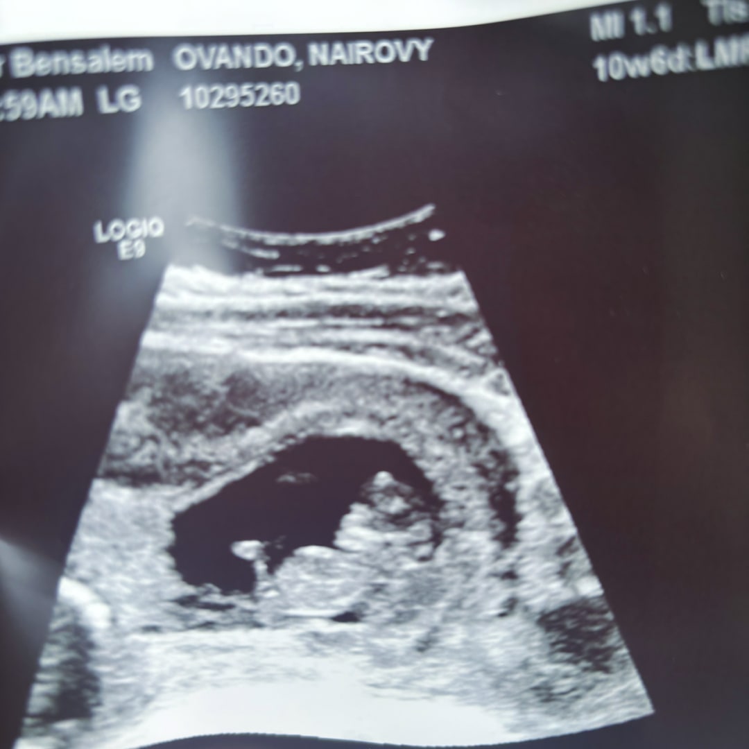 Photo shared by Nairoby for their Babylist baby registry.