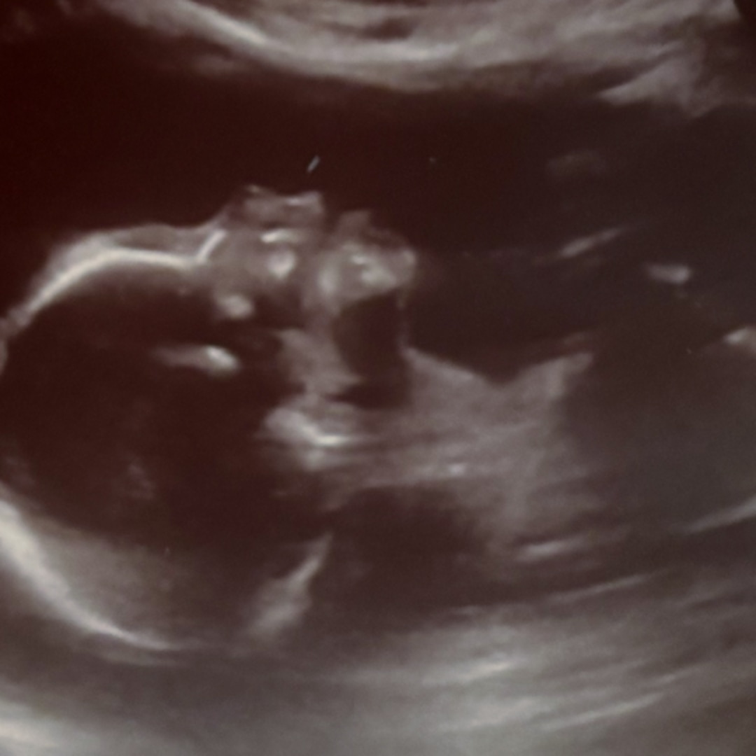Photo shared by Brittini for their Babylist baby registry.
