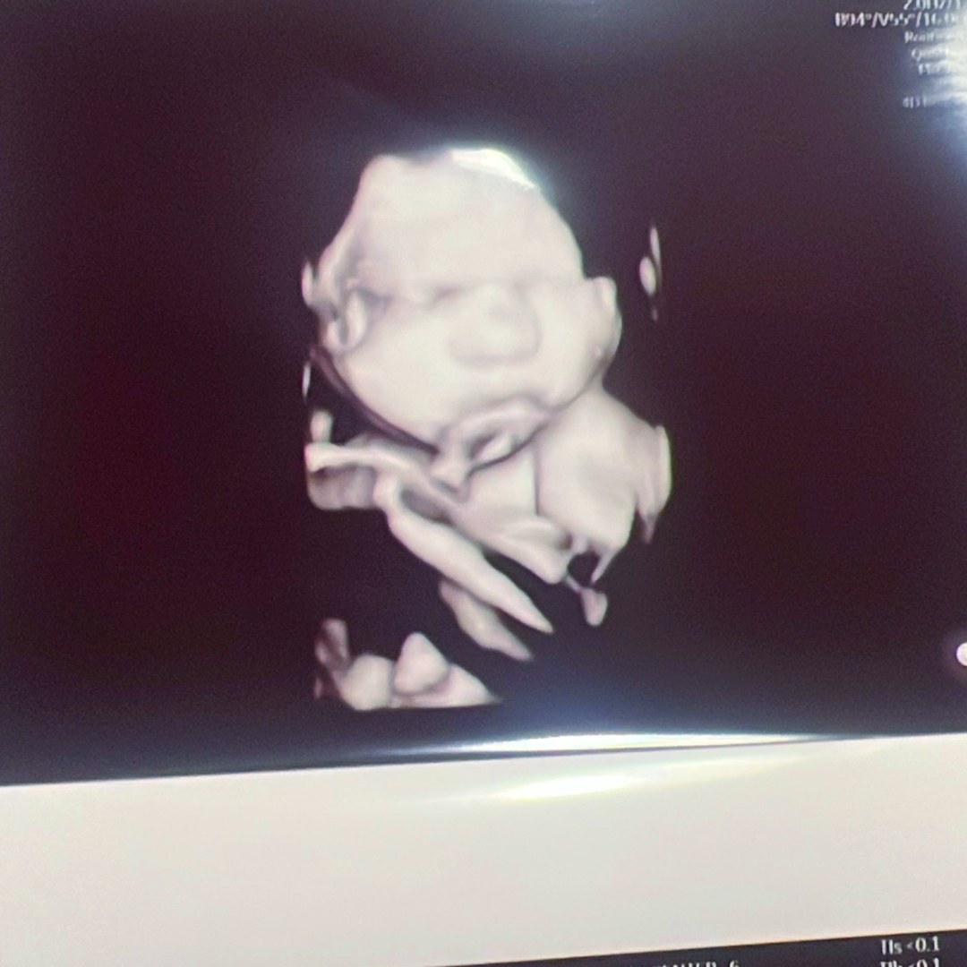 Photo shared by Belkis Johana for their Babylist baby registry.