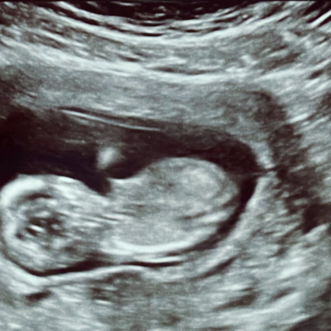 Photo shared by Evalin for their Babylist baby registry.
