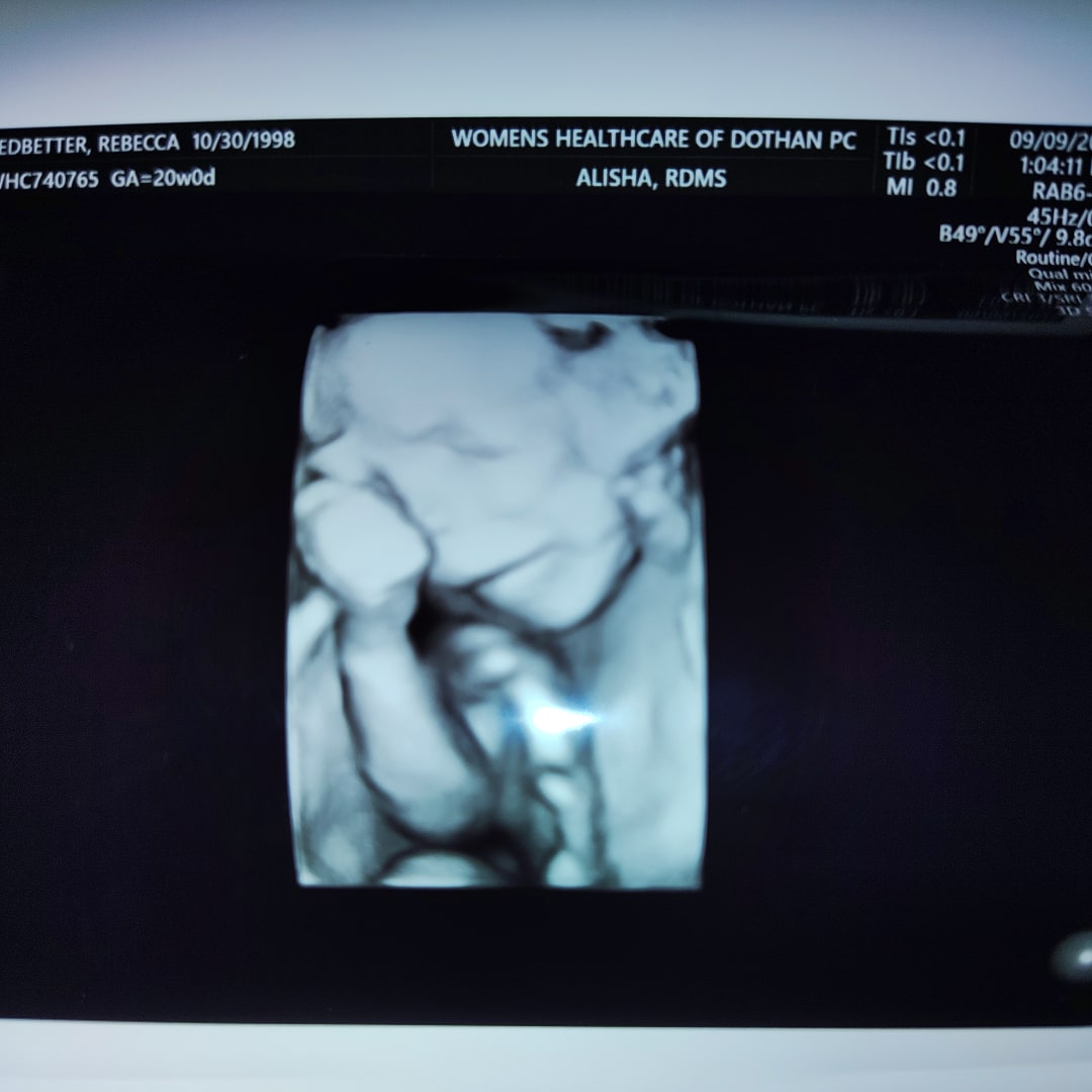Photo shared by Rebecca for their Babylist baby registry.