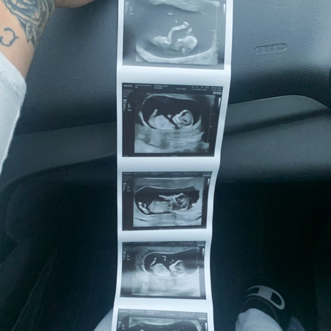 Photo shared by Lauren for their Babylist baby registry.