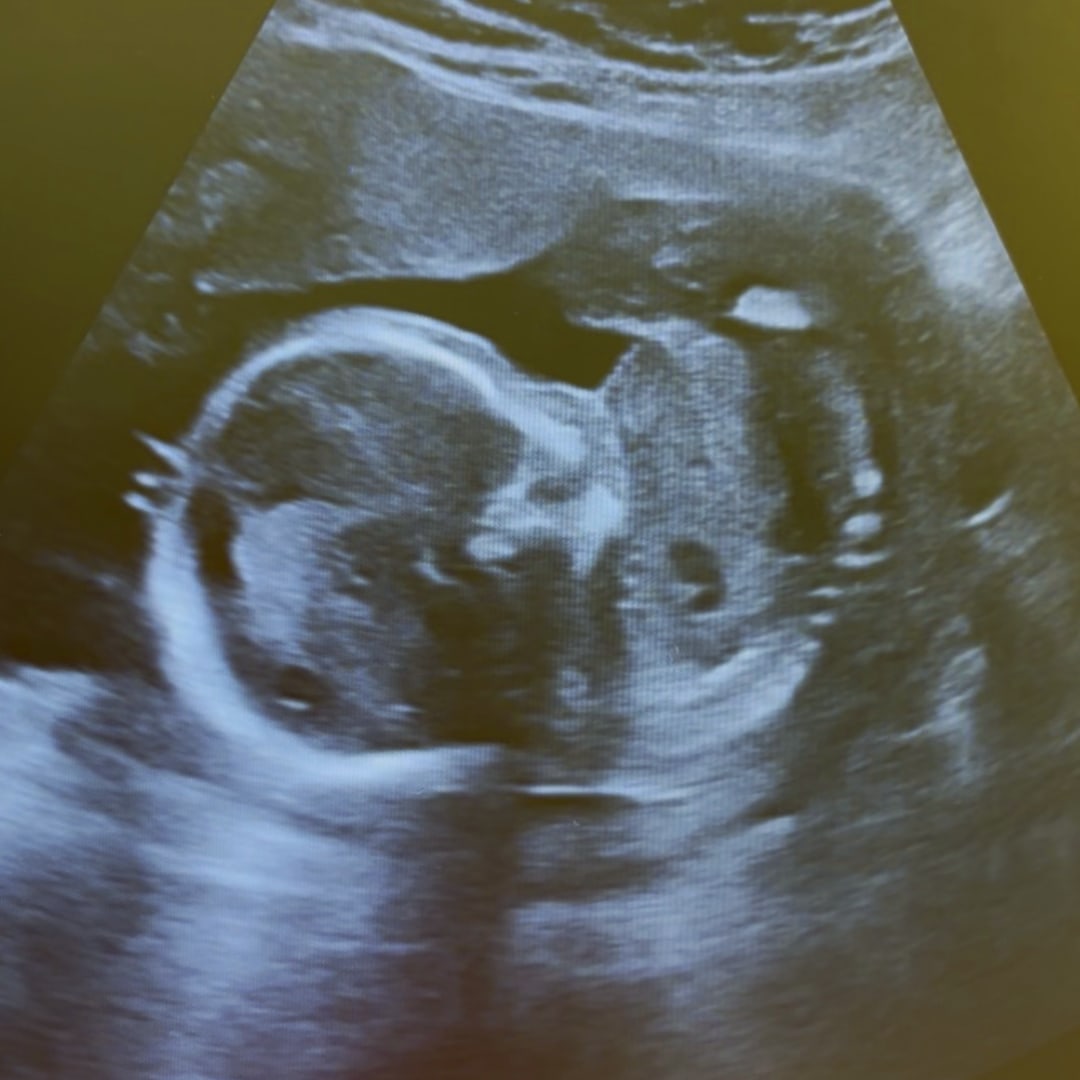 Photo shared by Amber for their Babylist baby registry.