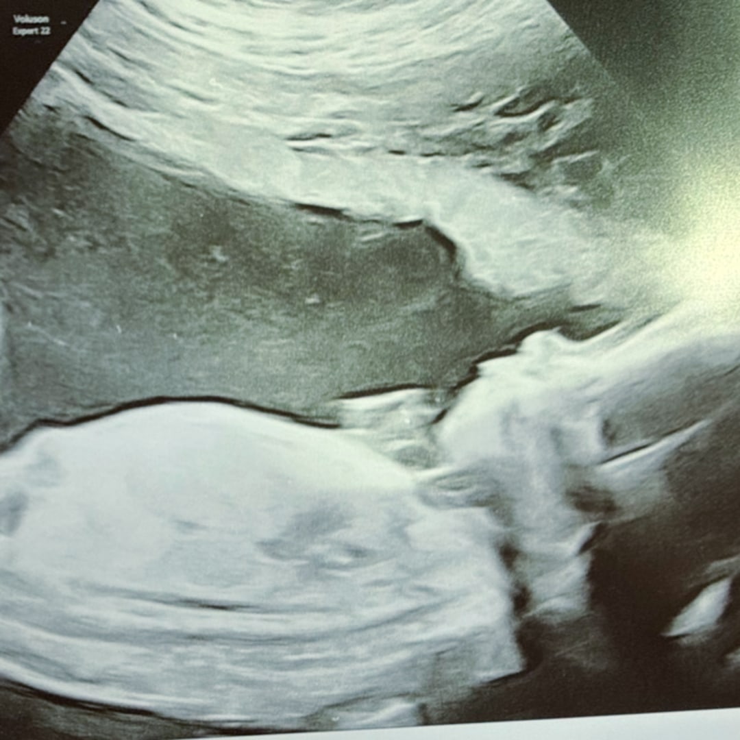 Photo shared by Carlety for their Babylist baby registry.