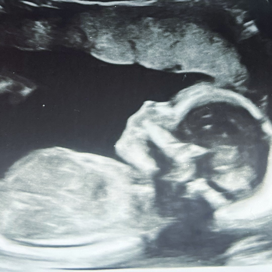 Photo shared by Christabelle for their Babylist baby registry.