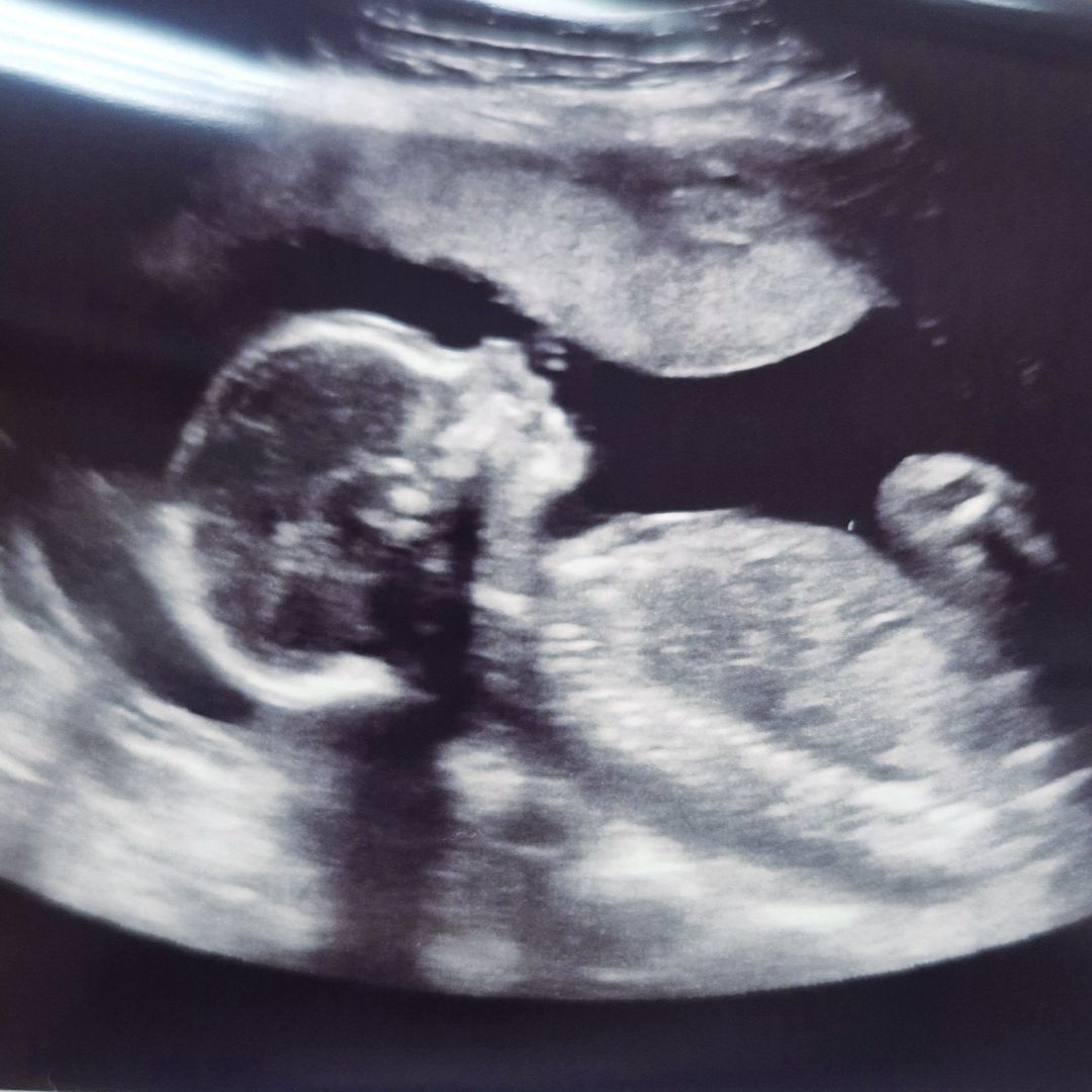 Photo shared by Madison for their Babylist baby registry.