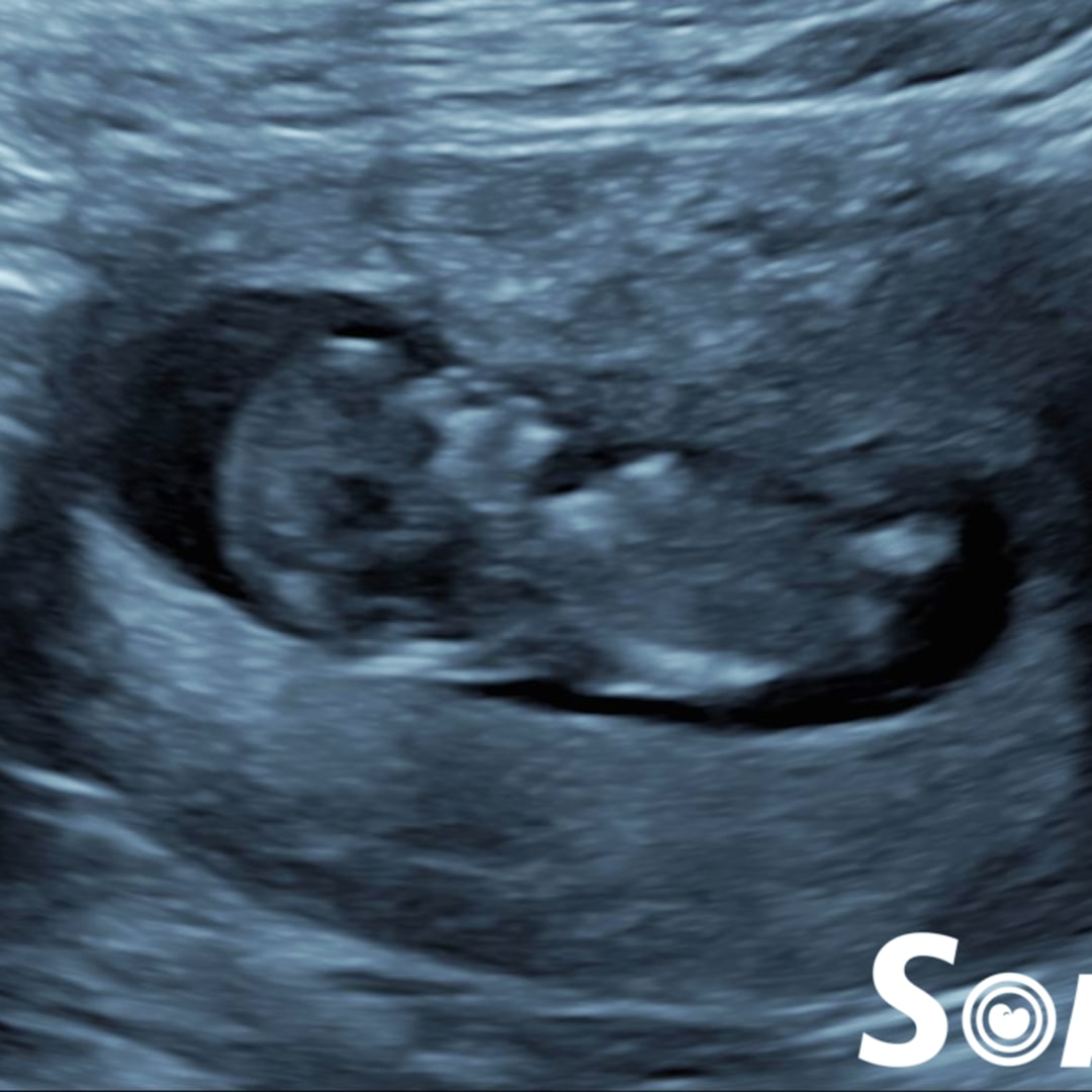 Photo shared by Alexis for their Babylist baby registry.