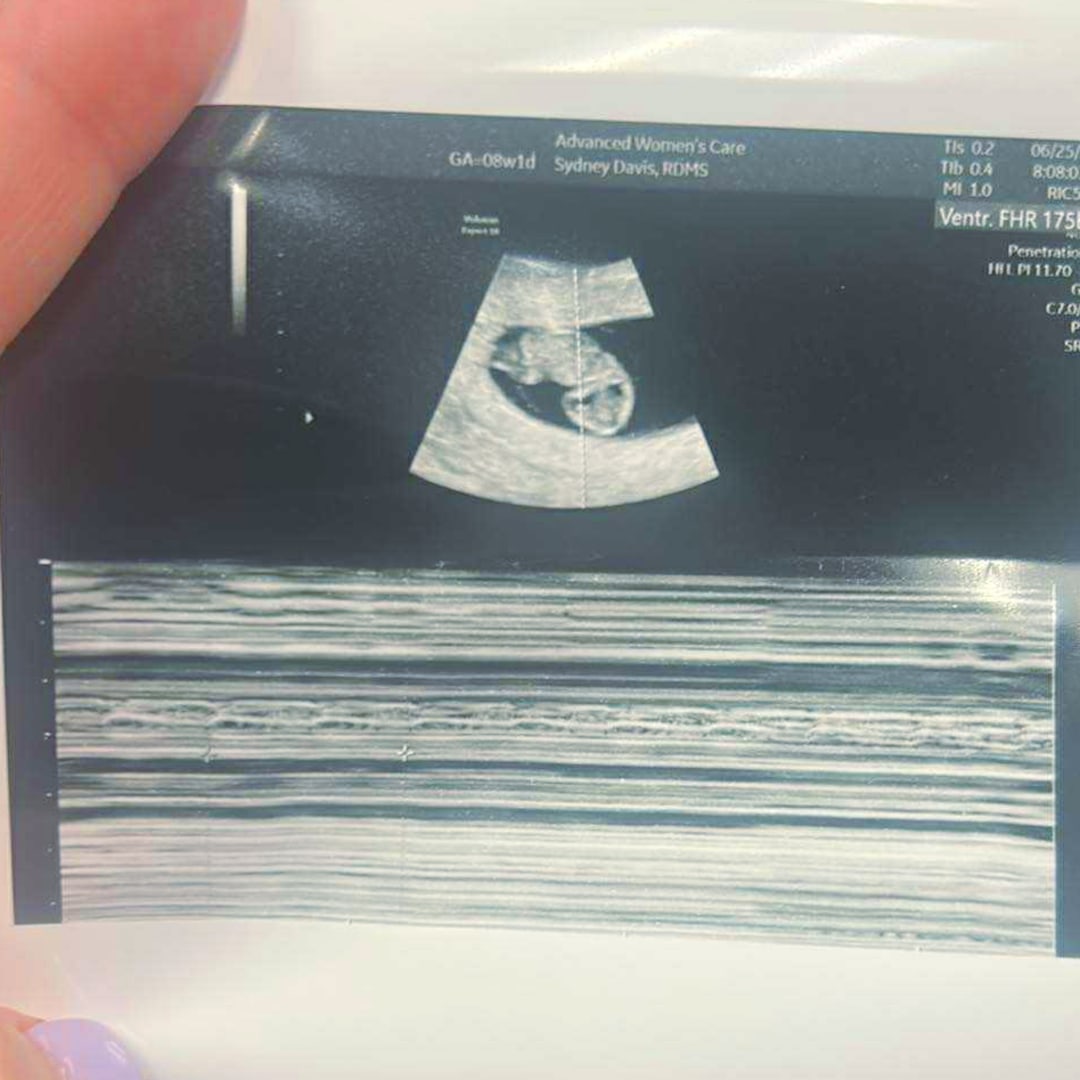Photo shared by Keegan for their Babylist baby registry.