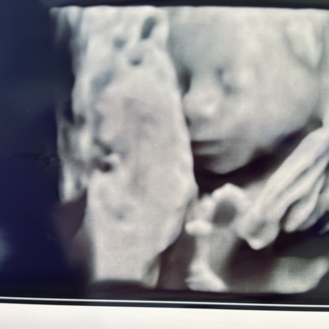 Photo shared by Charlotte for their Babylist baby registry.