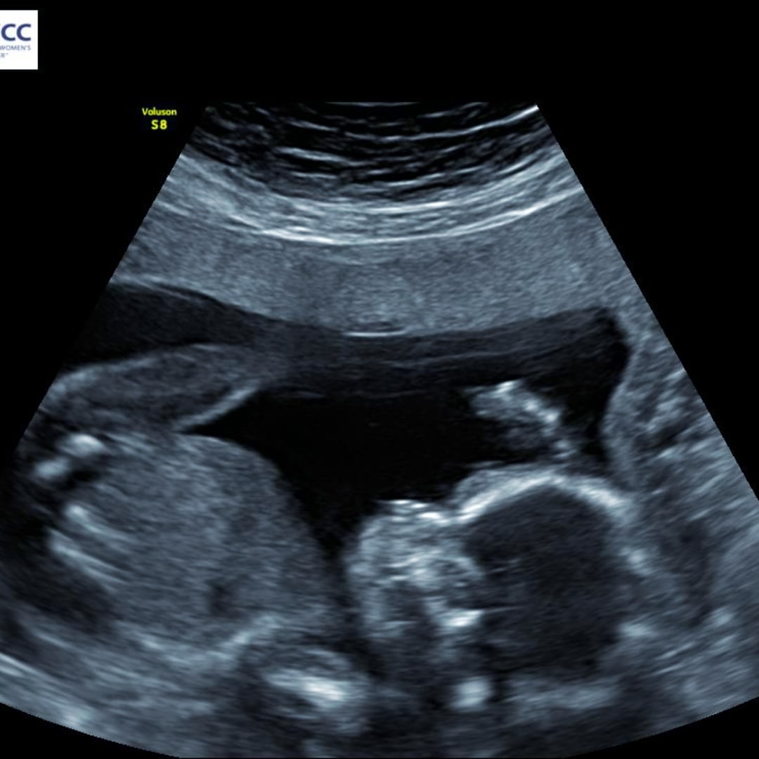 Photo shared by Allyson for their Babylist baby registry.