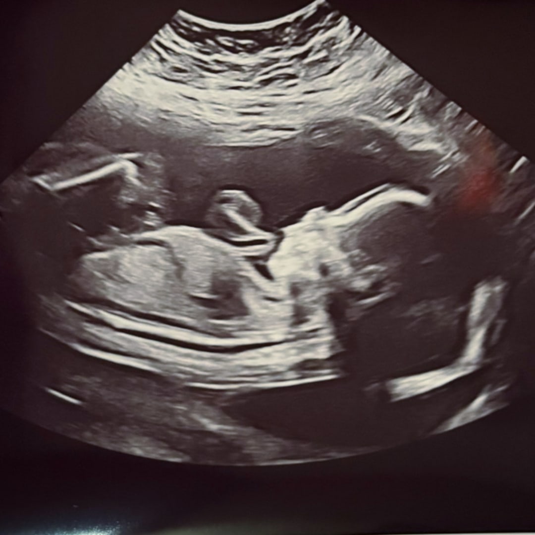 Photo shared by Bridget for their Babylist baby registry.