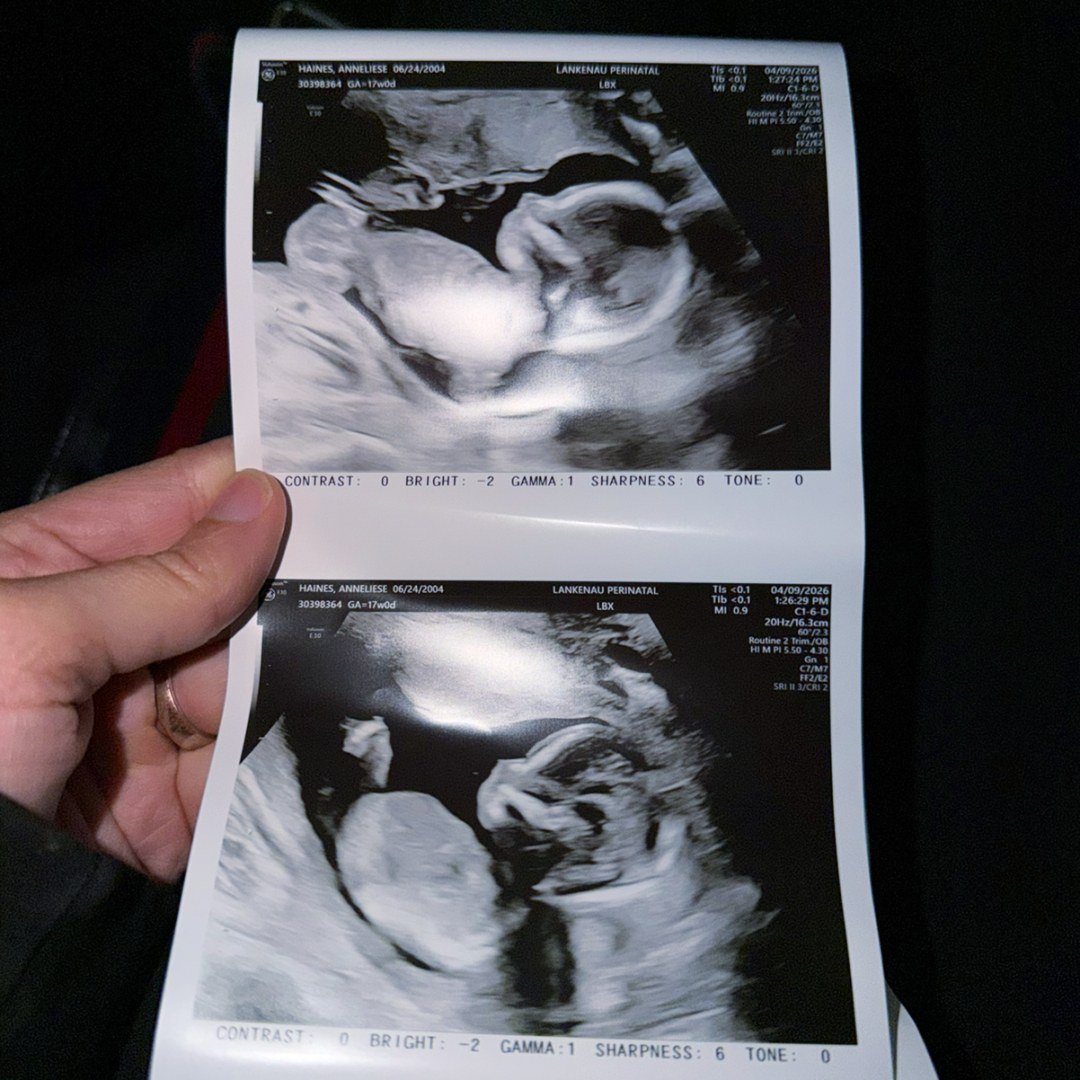 Photo shared by Anneliese for their Babylist baby registry.