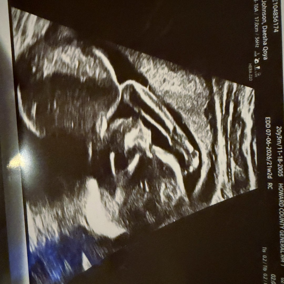 Photo shared by Daesha for their Babylist baby registry.