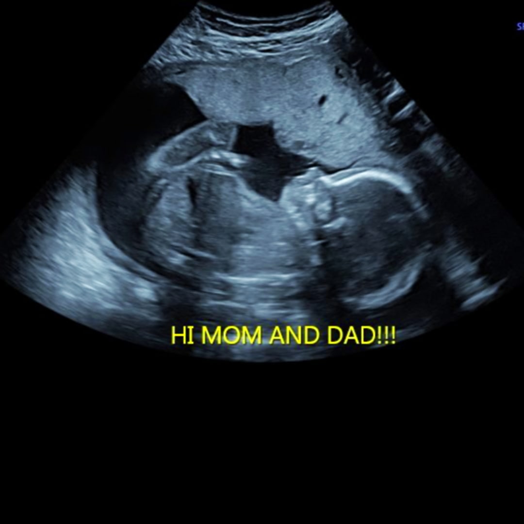 Photo shared by Aliyah for their Babylist baby registry.