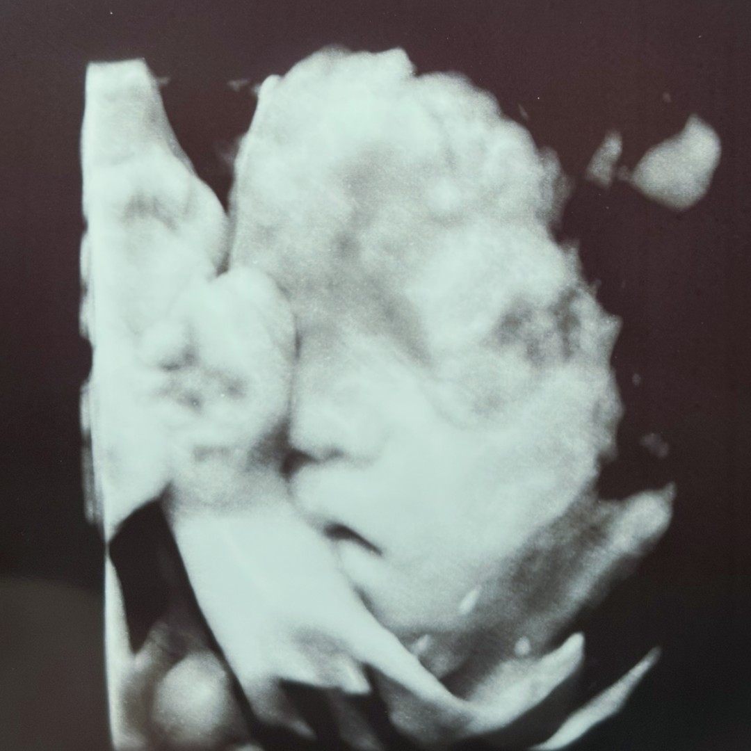 Photo shared by Jeylin for their Babylist baby registry.