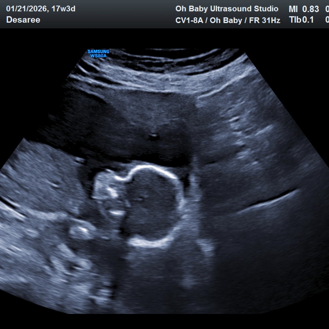 Photo shared by Desaree for their Babylist baby registry.