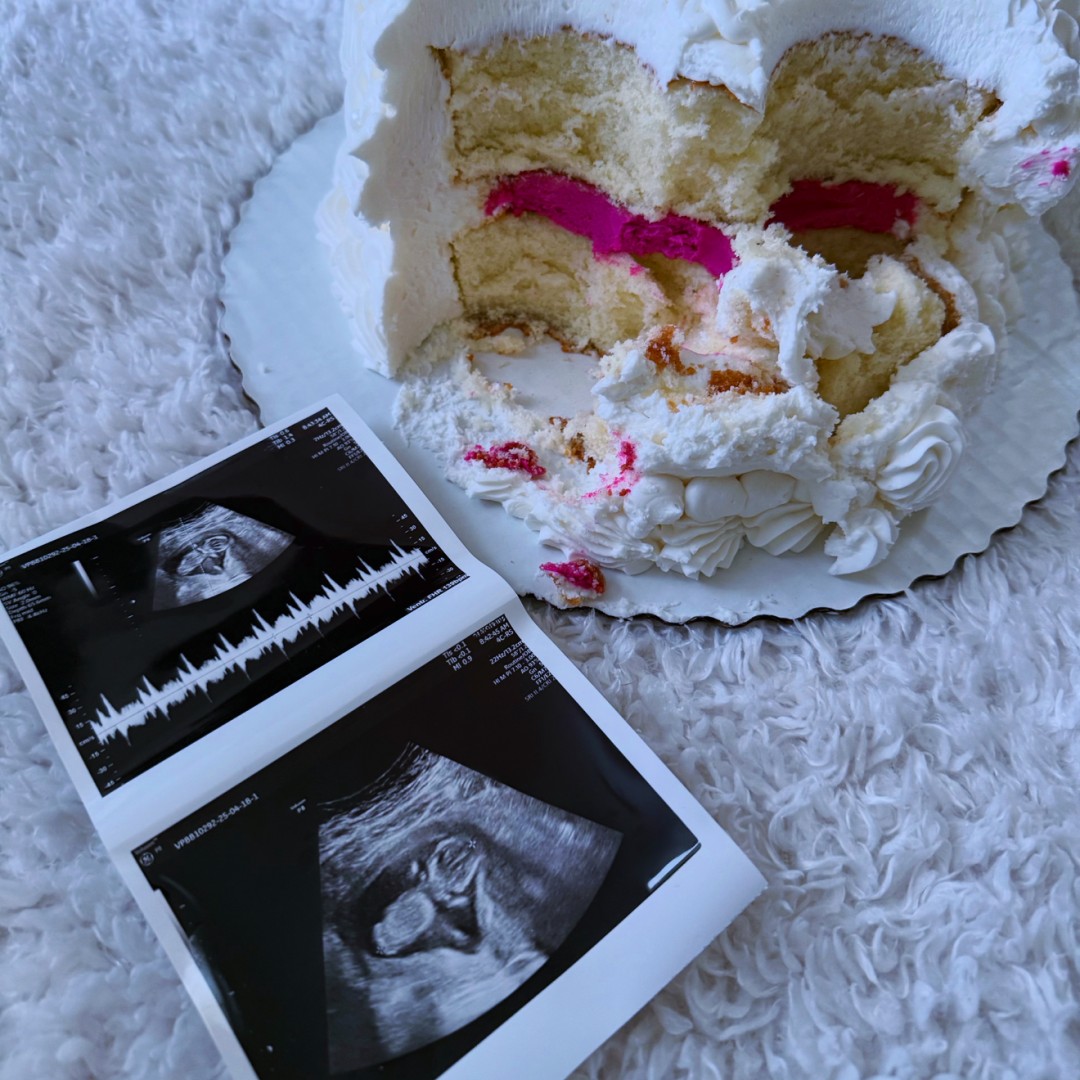 Photo shared by Carina for their Babylist baby registry.