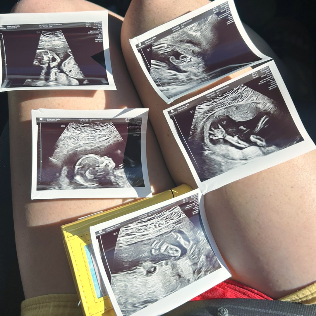 Photo shared by Callie for their Babylist baby registry.
