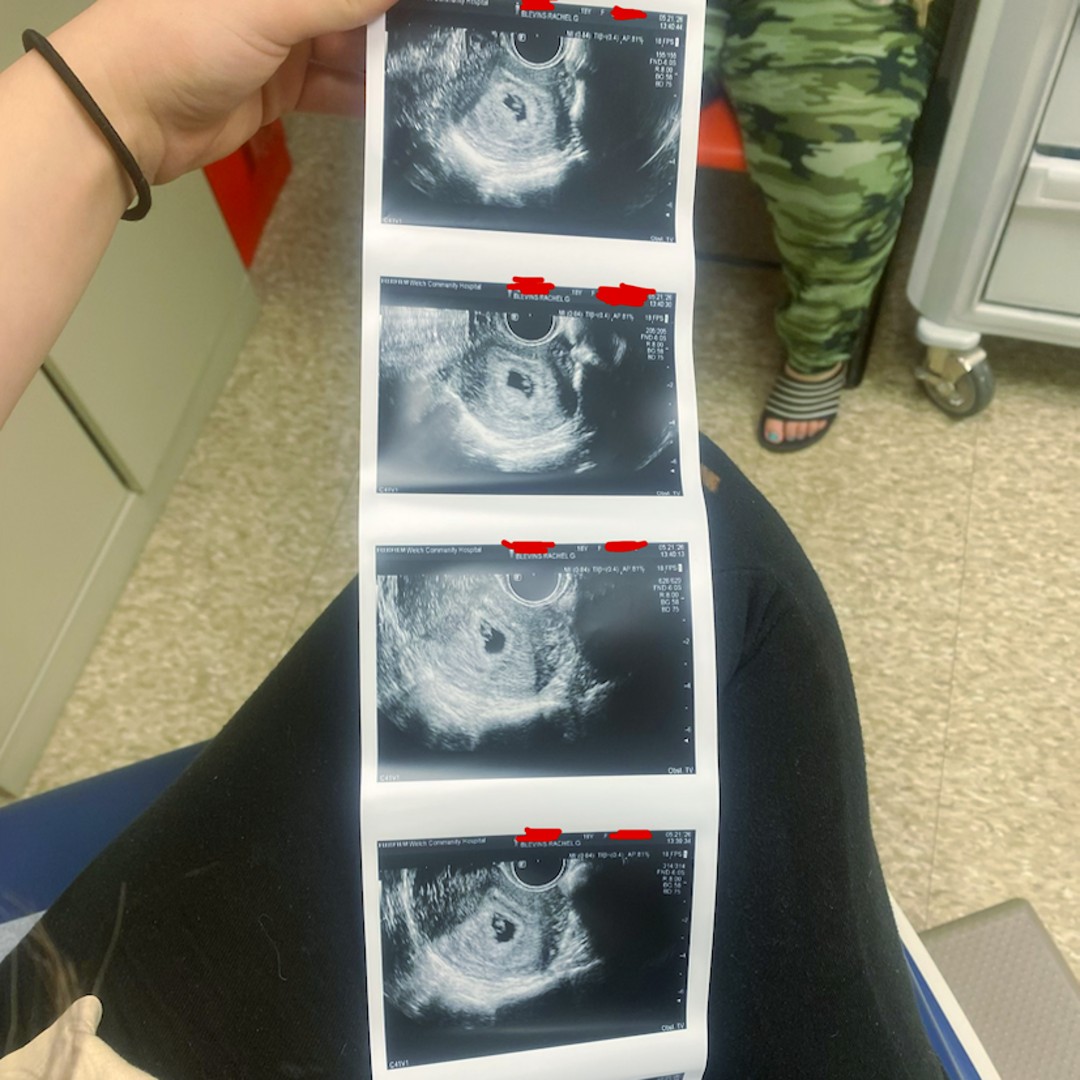 Photo shared by Rachel for their Babylist baby registry.