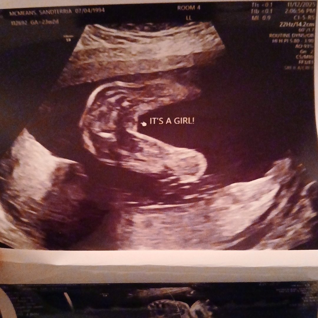 Photo shared by Sandterria for their Babylist baby registry.