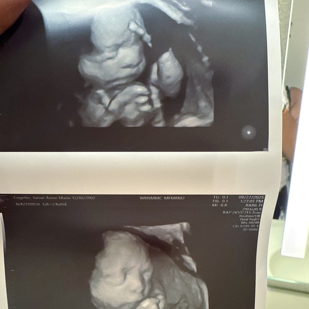 Photo shared by Janae for their Babylist baby registry.