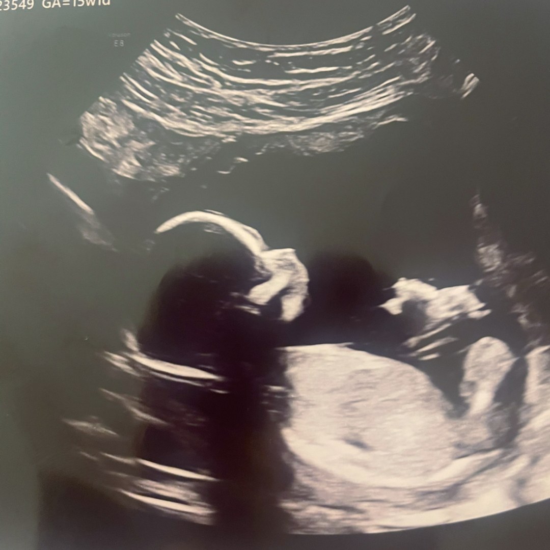 Photo shared by Emily for their Babylist baby registry.