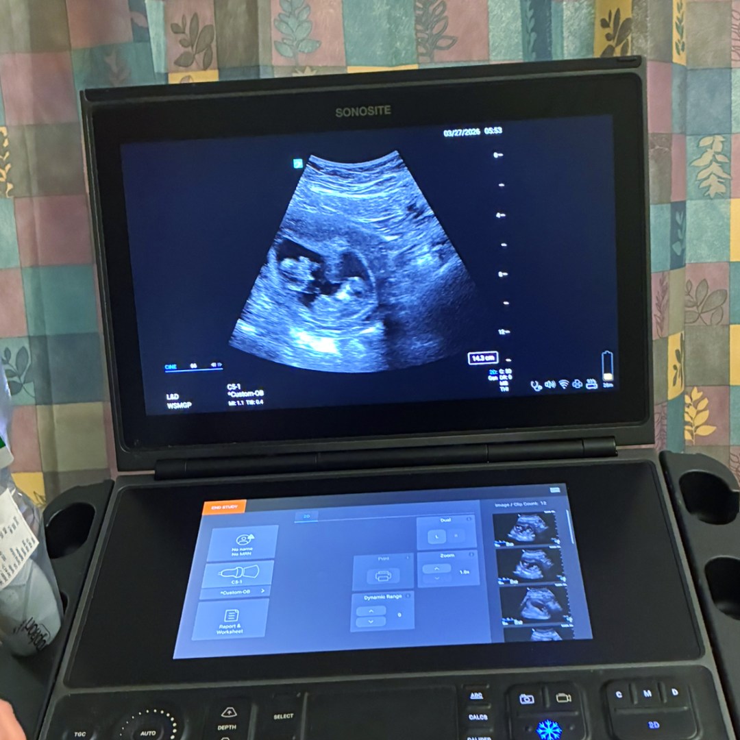 Photo shared by Amalia for their Babylist baby registry.