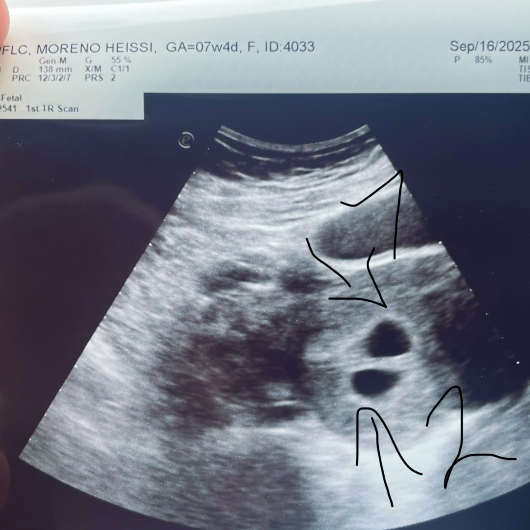 Photo shared by Heissi for their Babylist baby registry.