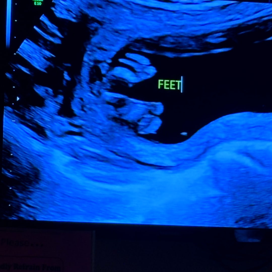 Photo shared by Aunya for their Babylist baby registry.