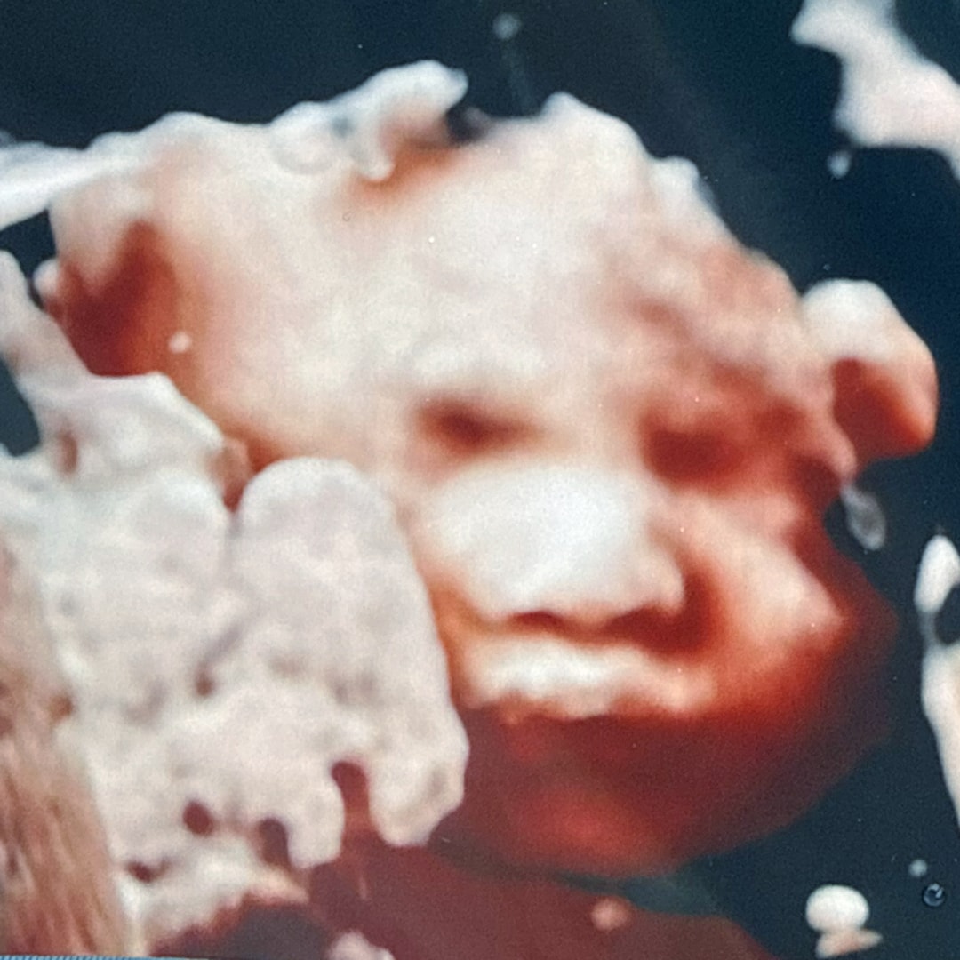 Photo shared by Marlee for their Babylist baby registry.