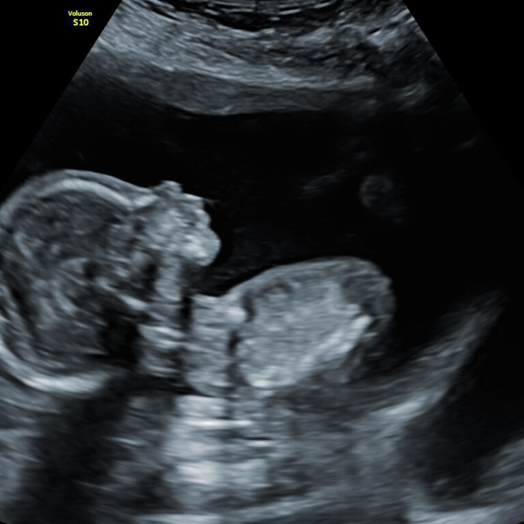 Photo shared by Dana for their Babylist baby registry.