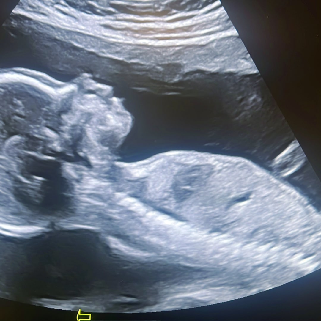 Photo shared by Stephanie for their Babylist baby registry.