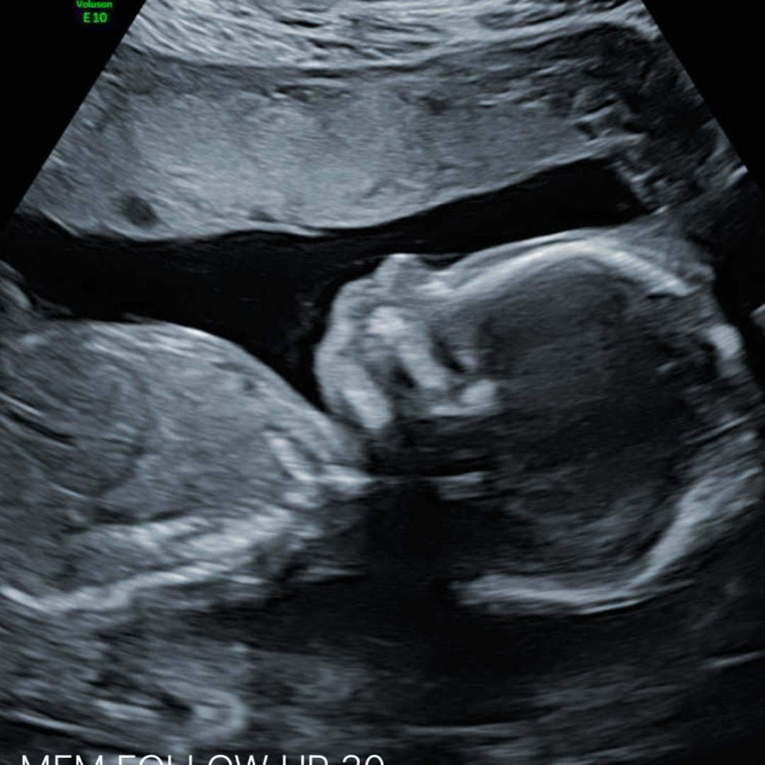 Photo shared by Robert for their Babylist baby registry.