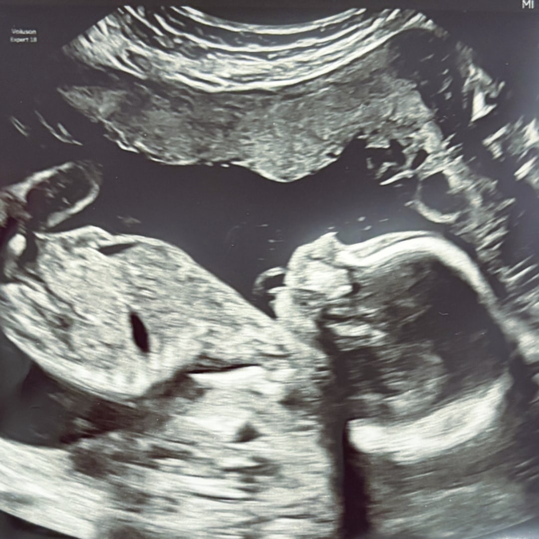 Photo shared by Abigayle for their Babylist baby registry.